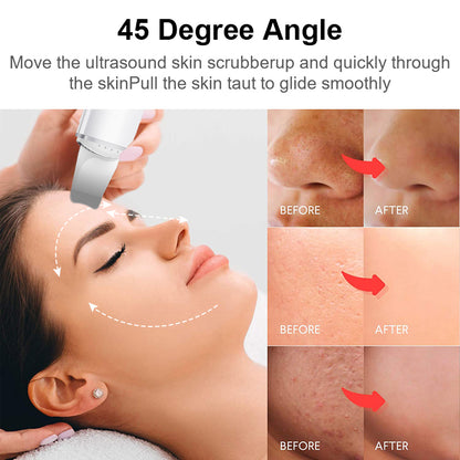 Woman using an ultrasound skin scrubber with before and after results shown on a white background.